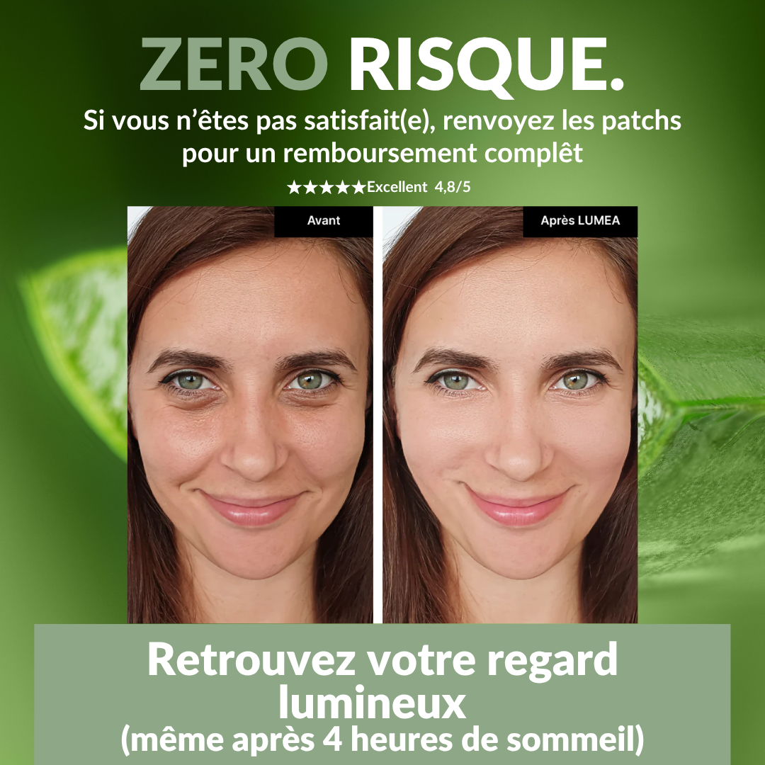 Patchs Anti-Cernes Nuit Blanche™️